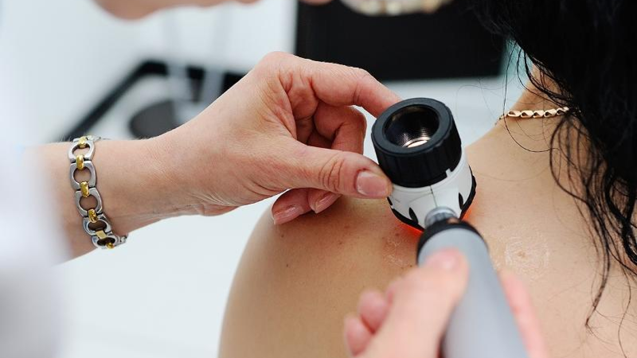 Melanoma-studio-Iqvia-meno-di-un-italiano-su-4-controlla-i-nei.jpg